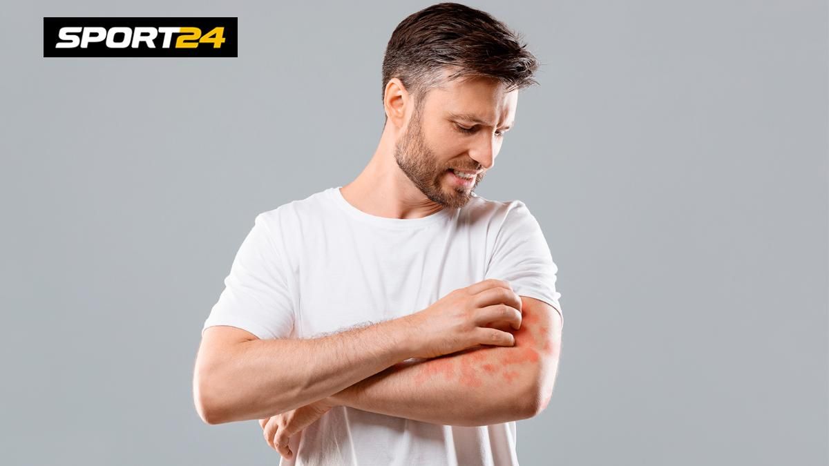 Псориаз: что за заболевание, как выглядит, симптомы, почему возникает ...