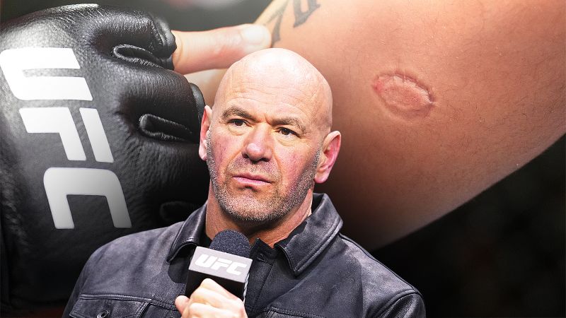 Боец UFC укусил соперника и был дисквалифицирован и уволен, Андре Лима ...