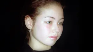 «Набивает себе цену». Ляйсан Утяшева получила жуткую травму, но ей никто не поверил 