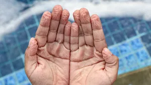 Оказывается, ученые не знают наверняка, почему кожа морщится после воды: есть только версии