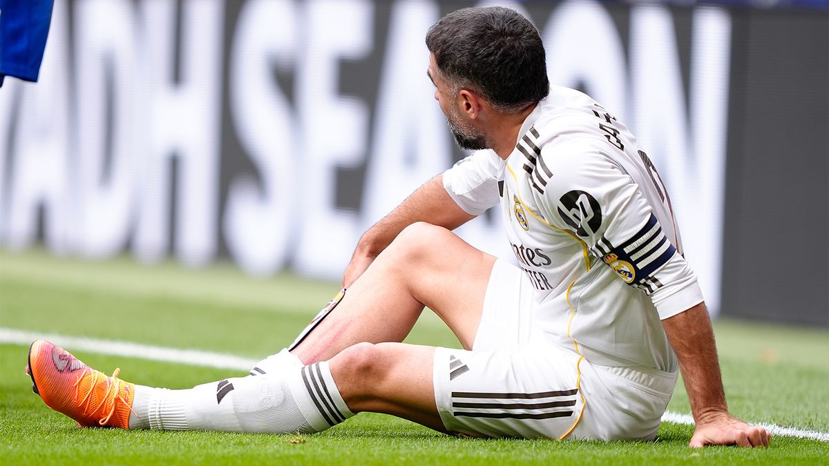 Капитан «Реала» Карвахаль успешно перенес операцию на колене