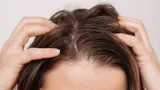 Почему быстро жирнеют волосы: причины и способы решения проблемы