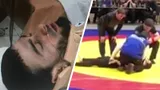 Борец из Дагестана сломал позвоночник на Кубке мира по грэпплингу. У него парализованы руки и ноги
