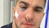 Боец Тамаев — об избиении в Махачкале: «Махмудова хотят посадить на 8 лет, хотя с моей стороны не было претензий»