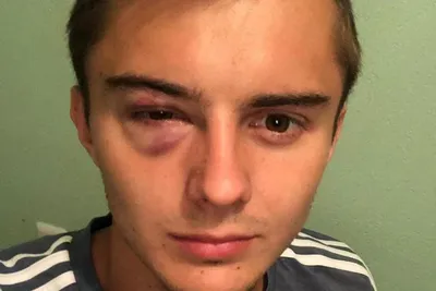 Александр Зуев