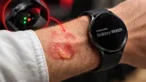 Samsung пошла по стопам Apple: пользователи Galaxy Watch массово жалуются на ожоги при ношении часов