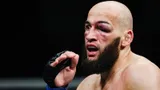 Боец UFC из России обещал «убить» соперника. После второго раунда Дураева сняли с боя из-за огромной гематомы