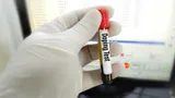 Испанское антидопинговое агентство на протяжении 5 лет аннулировало положительные пробы своих спортсменов
