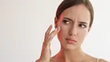 Как помочь коже избавиться от сухости зимой: инструкция от врача