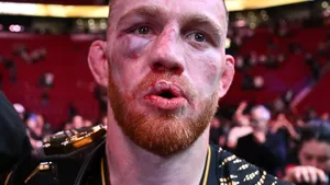 Работа в офисе, регби, бокс и провальный дебют в ММА. Что нужно знать о чемпионе, который мечтает вырубить Махачева