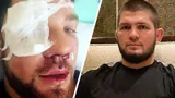 «Думал, что это фейк». Избитый дагестанцами в метро москвич отреагировал на шутку Хабиба про Конора и медаль