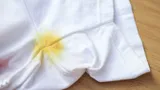 Рассказываю, как отстирать одуванчик с одежды: домашние средства спасут вещи от желтых пятен 