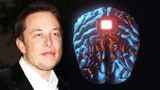 Илон Маск презентовал программу чипирования людей. Чипы для мозга будут размером с монету и со временем подешевеют