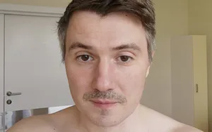 «Гаже я в жизни не болел — 40% легких было поражено». Стогниенко — о ковиде