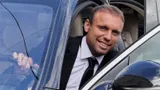 Глушаков — после пересадки волос: «Помолодел лет на 20, уже не все узнают»